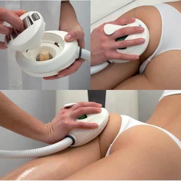 Urządzenie masaż endodermiczny RF ultradźwięki
